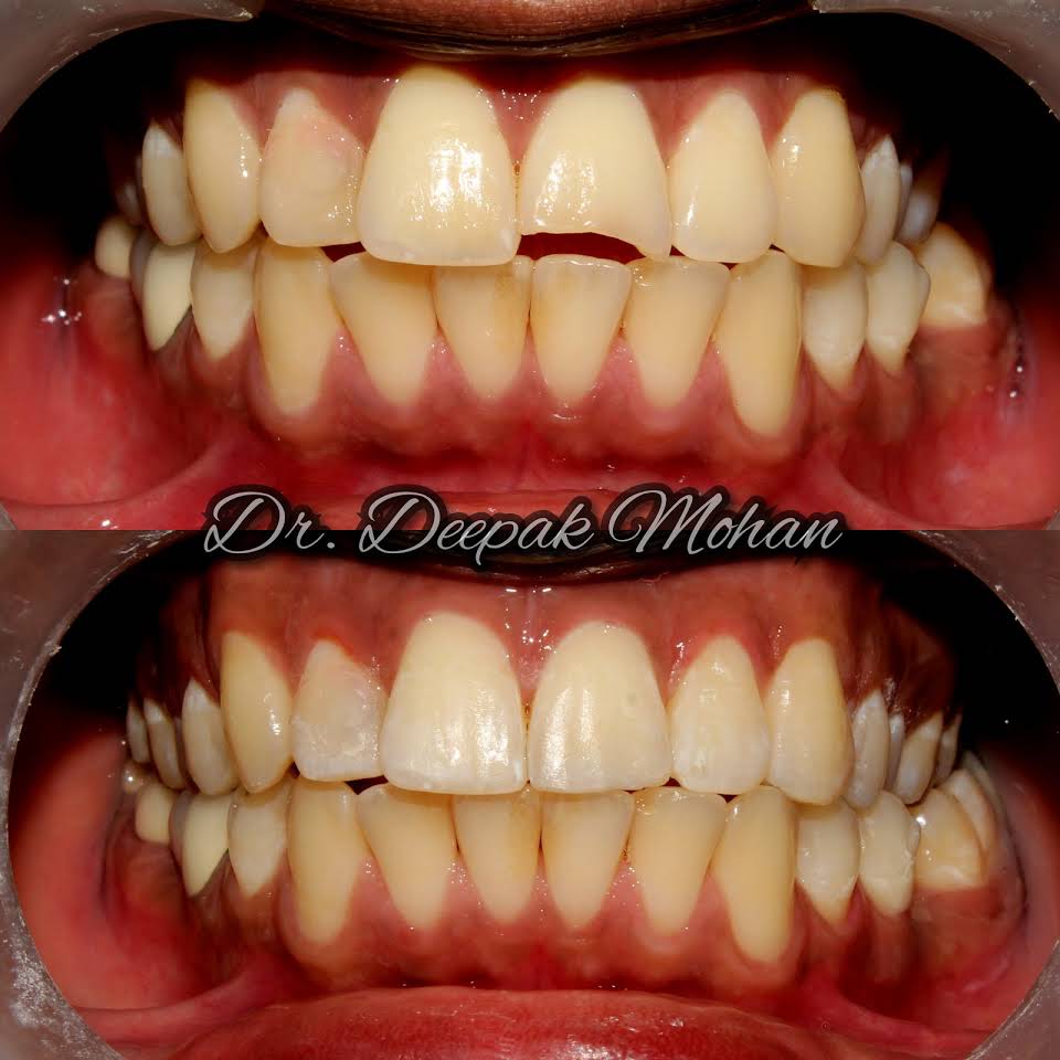 Suraksha Speciality Dental Care - Dr Deepak Mohan